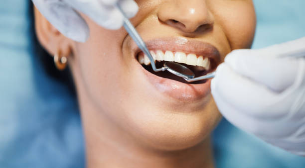 Best Emergency Dental Care for Sports Injuries in Crompond, NY
